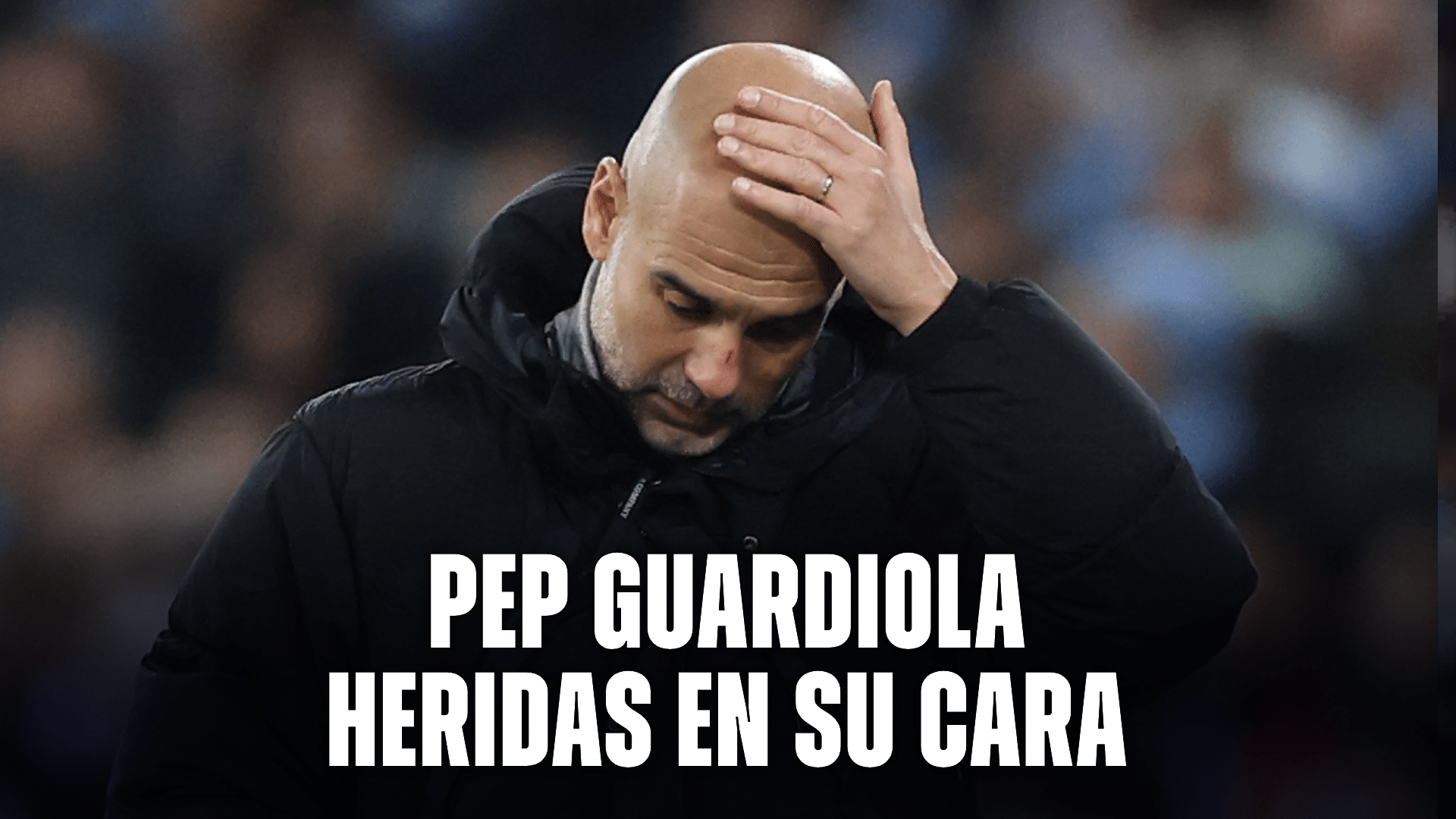 Pep Guardiola herido en su cara: Qué le pasó al DT español